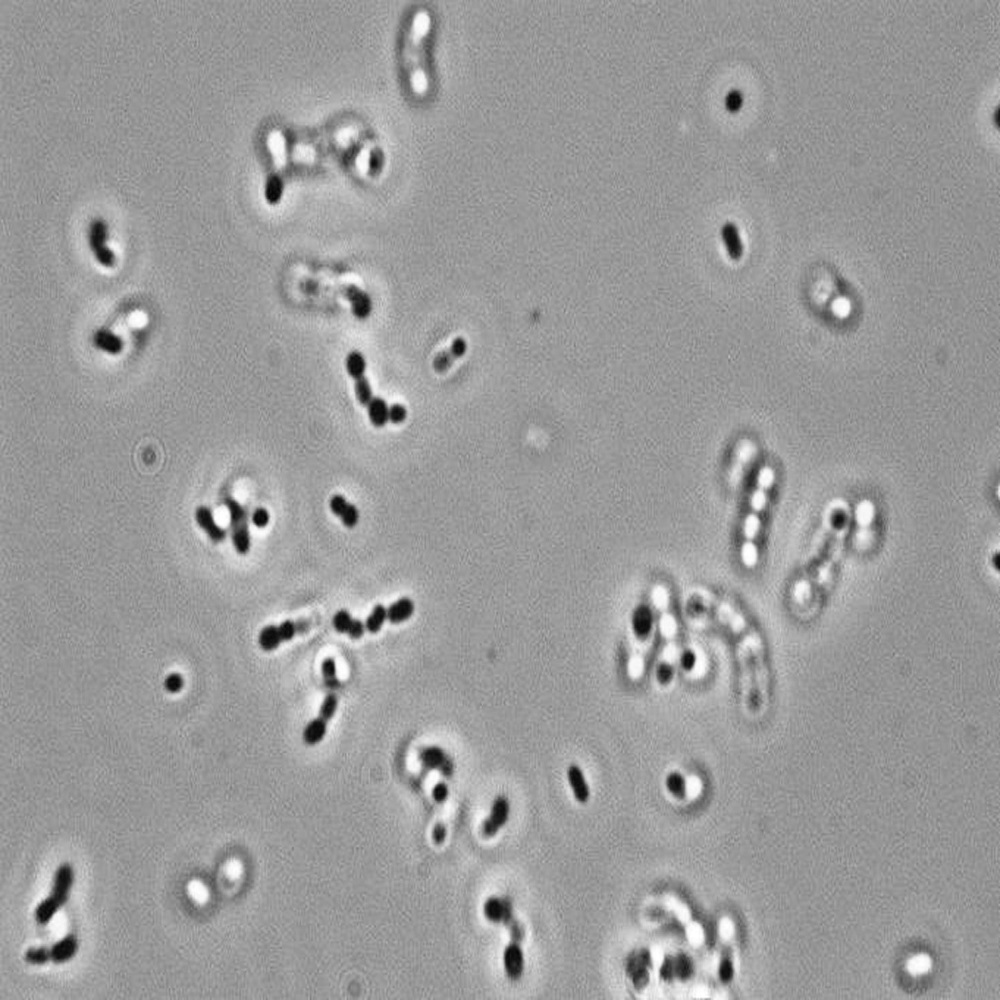 yeast under microscope
