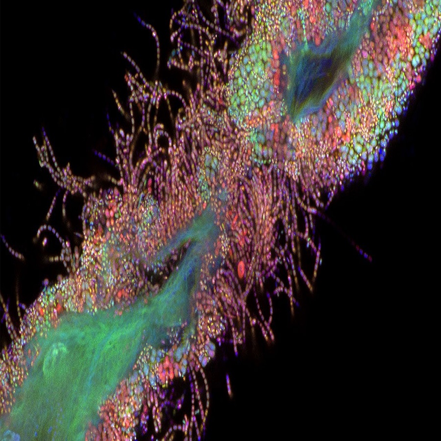 germs under a microscope
