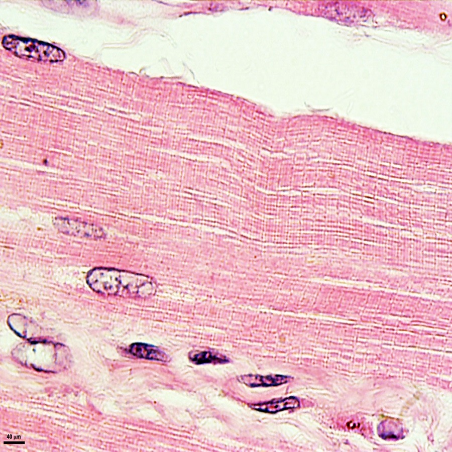 skeletal muscle under microscope
