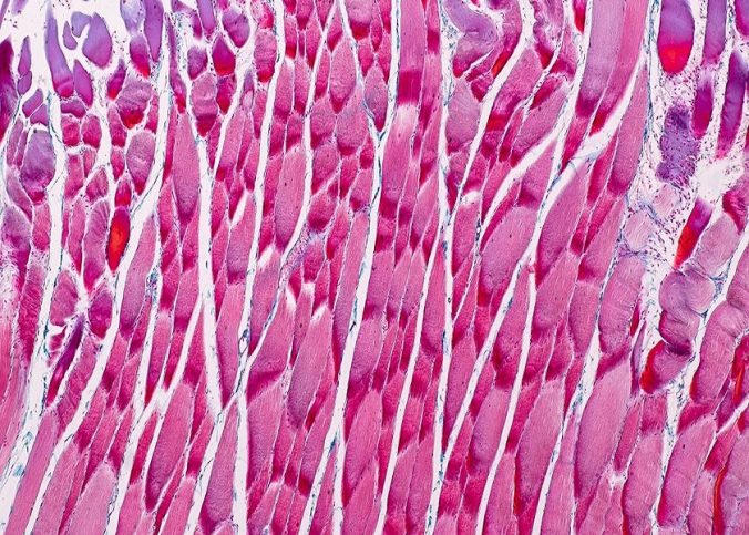 skeletal muscle under microscope