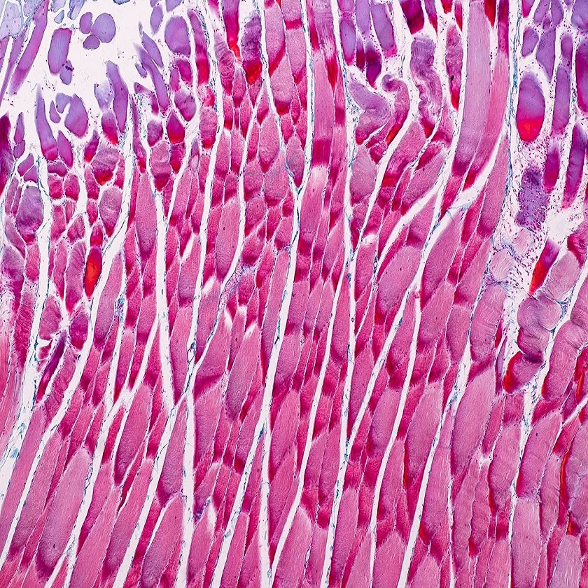 skeletal muscle under microscope