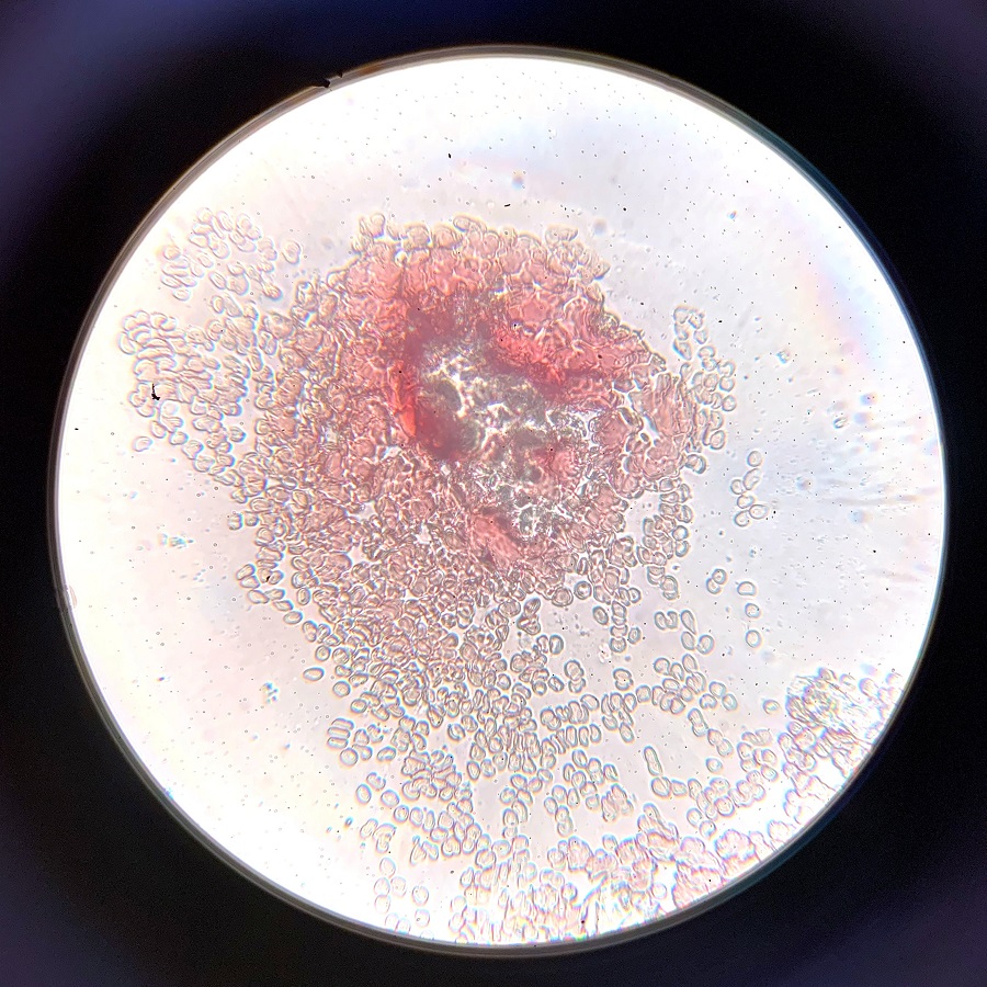 blood under microscope
