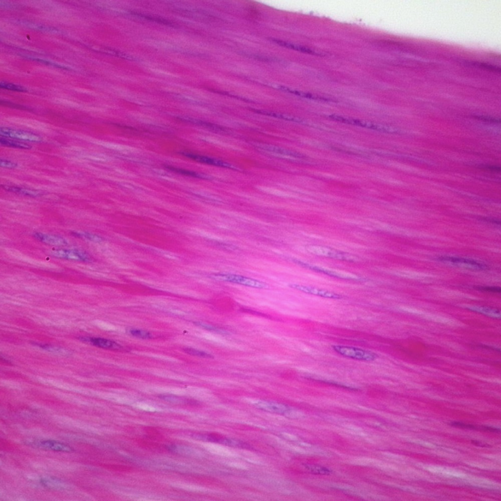 smooth muscle under microscope
