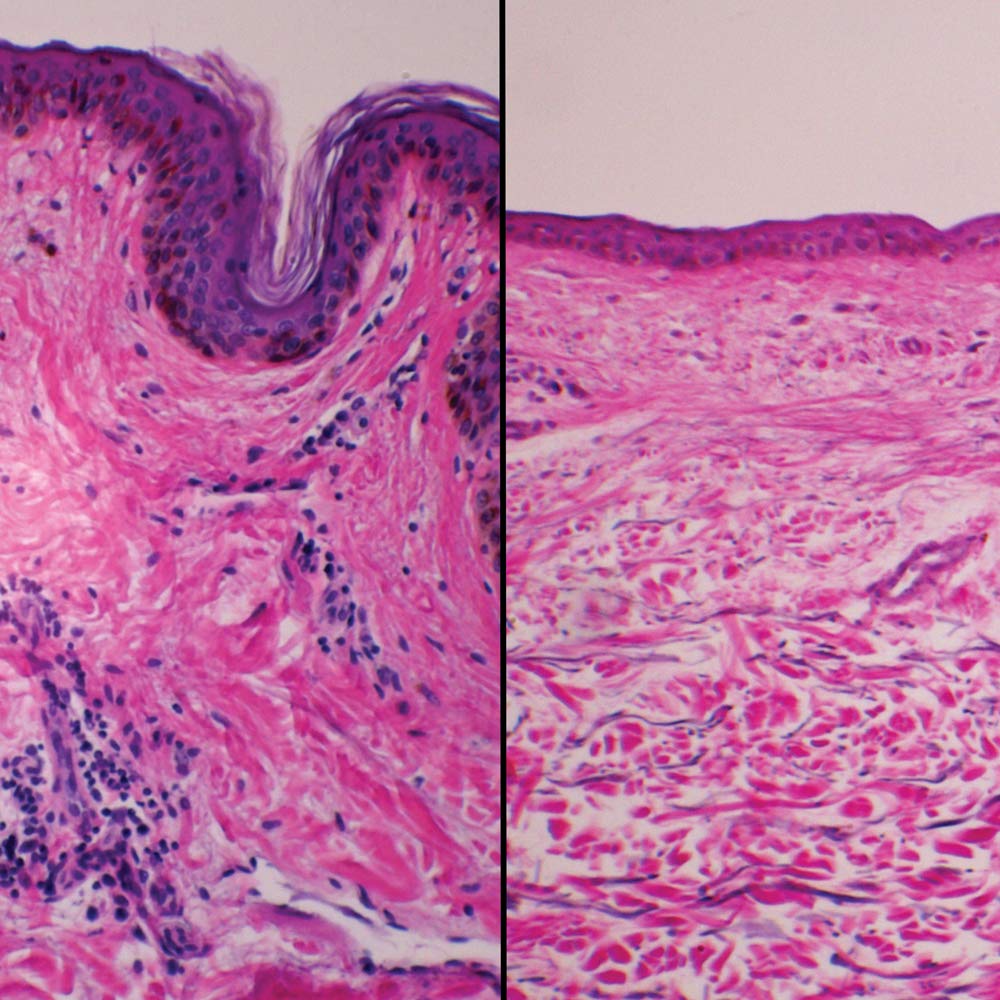 skin under microscope