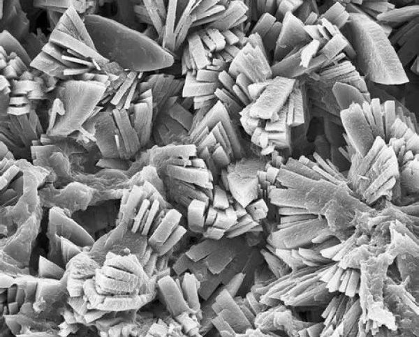 kidney stone microscope