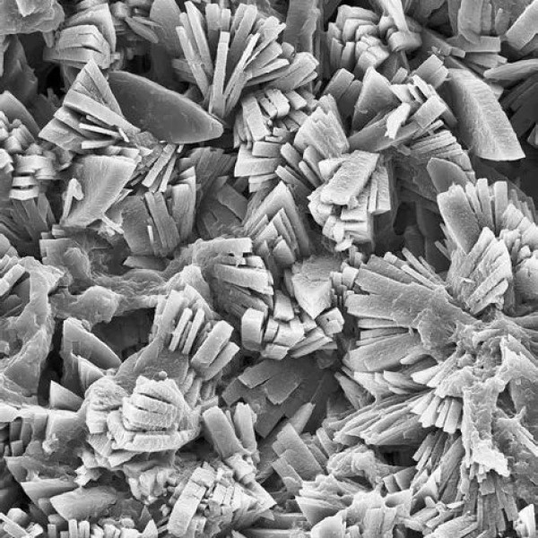 kidney stone microscope