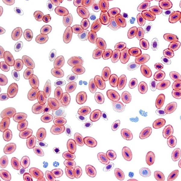 blood cells under microscope